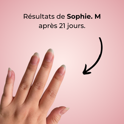 Sérum Réparateur et de Croissance des Ongles (1 Acheté = 1 OFFERT)
