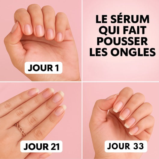 Sérum Réparateur et de Croissance des Ongles (1 Acheté = 1 OFFERT)