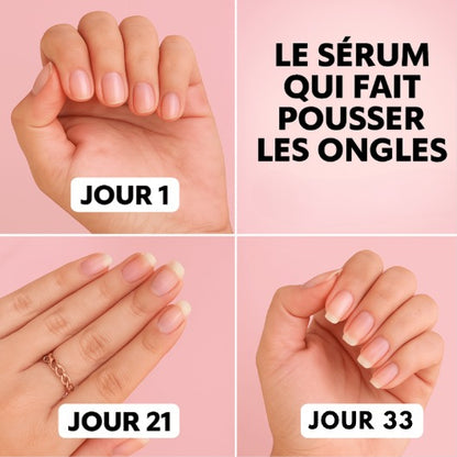 Sérum Réparateur et de Croissance des Ongles (1 Acheté = 1 OFFERT)
